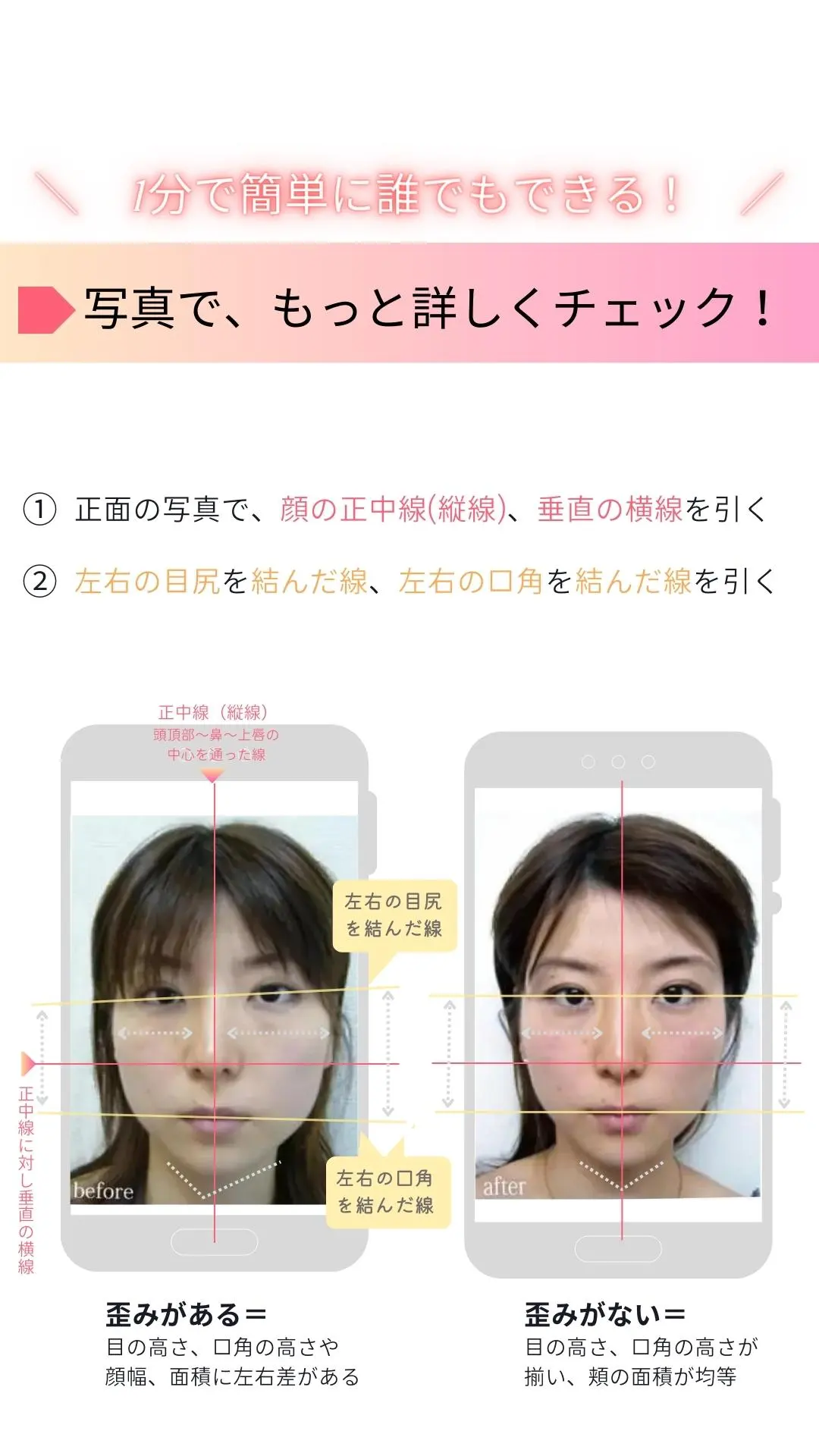 顔の歪み