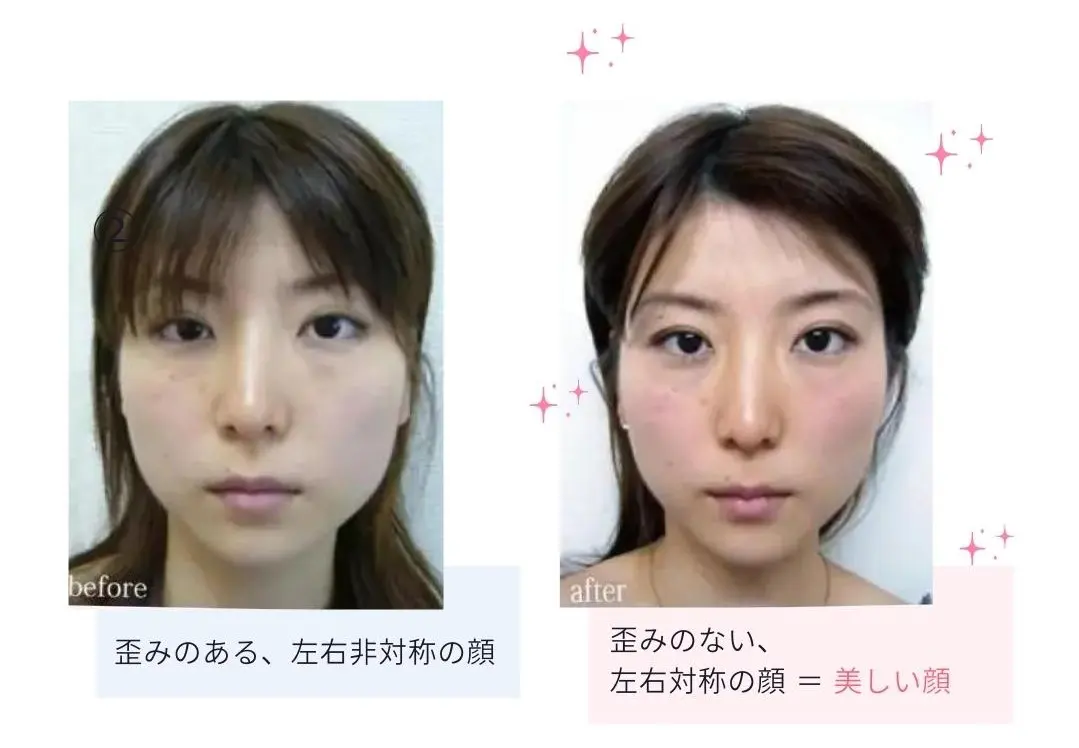 顔の歪み