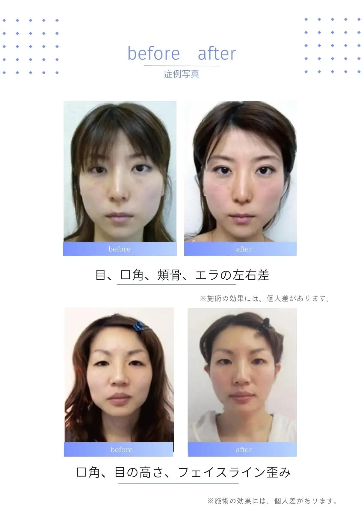 顔の歪み