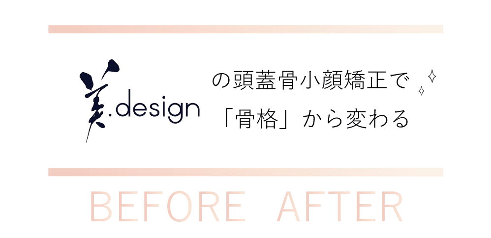 頭蓋骨矯正Before-Afterタイトル