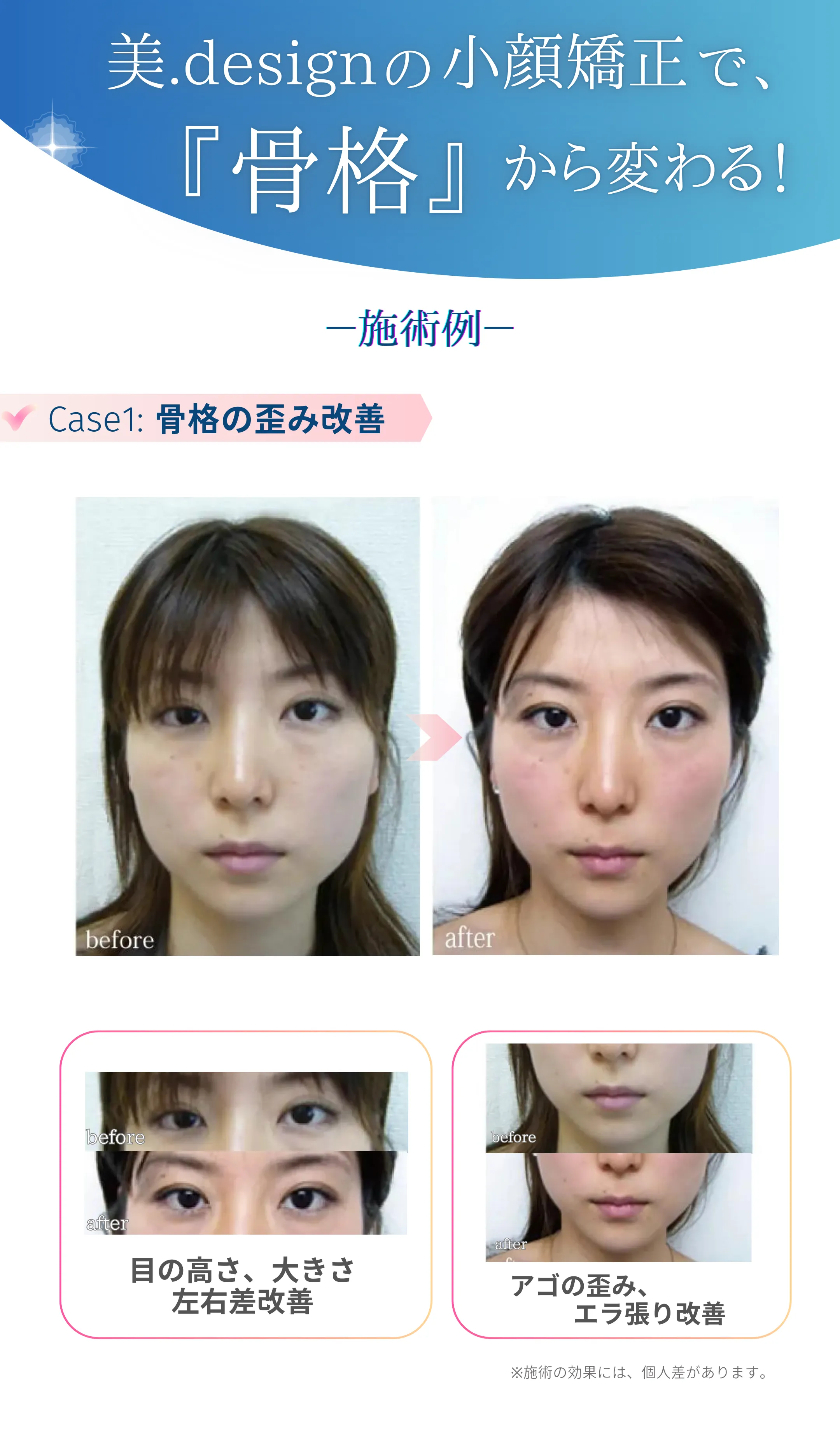 施術例