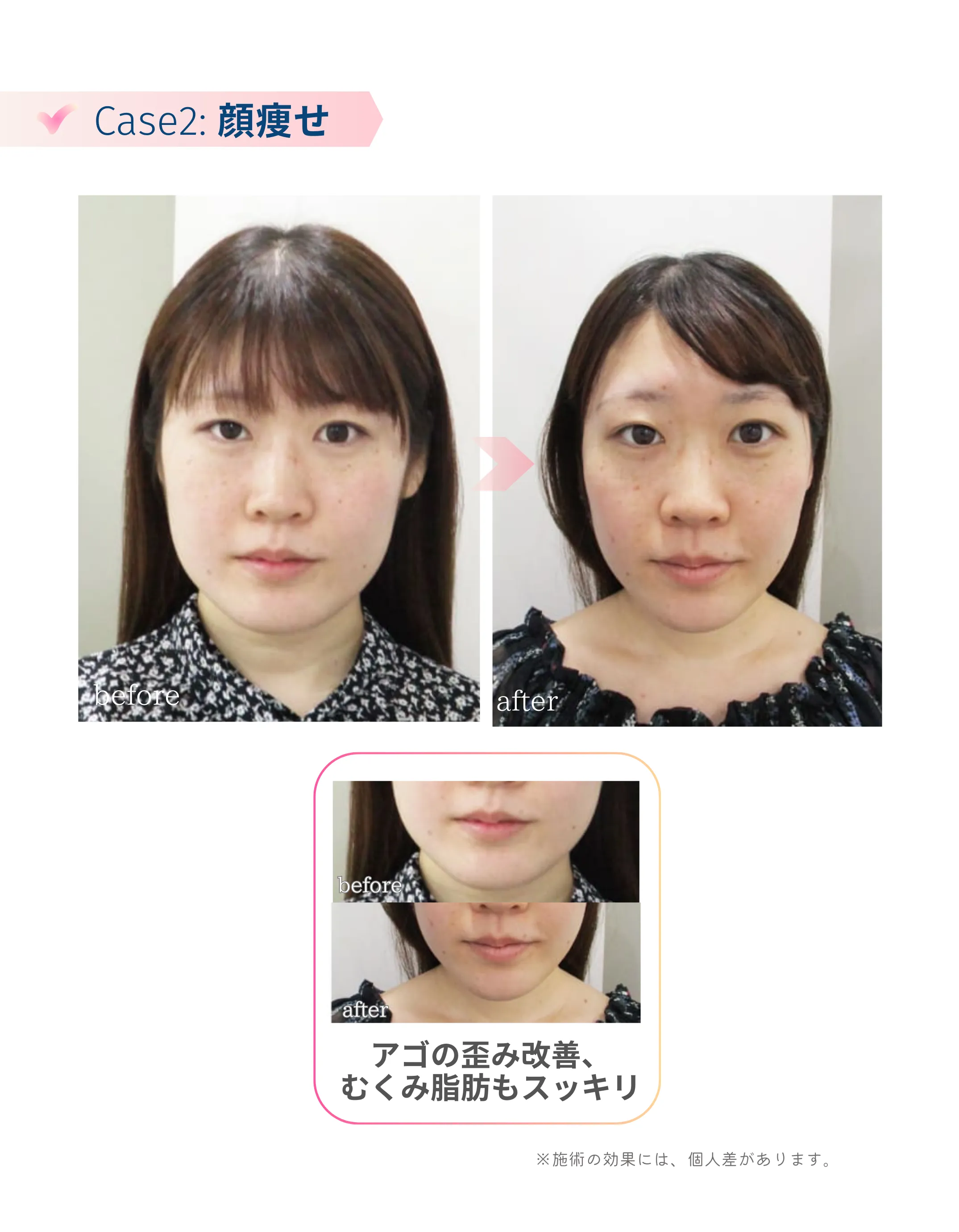 施術例