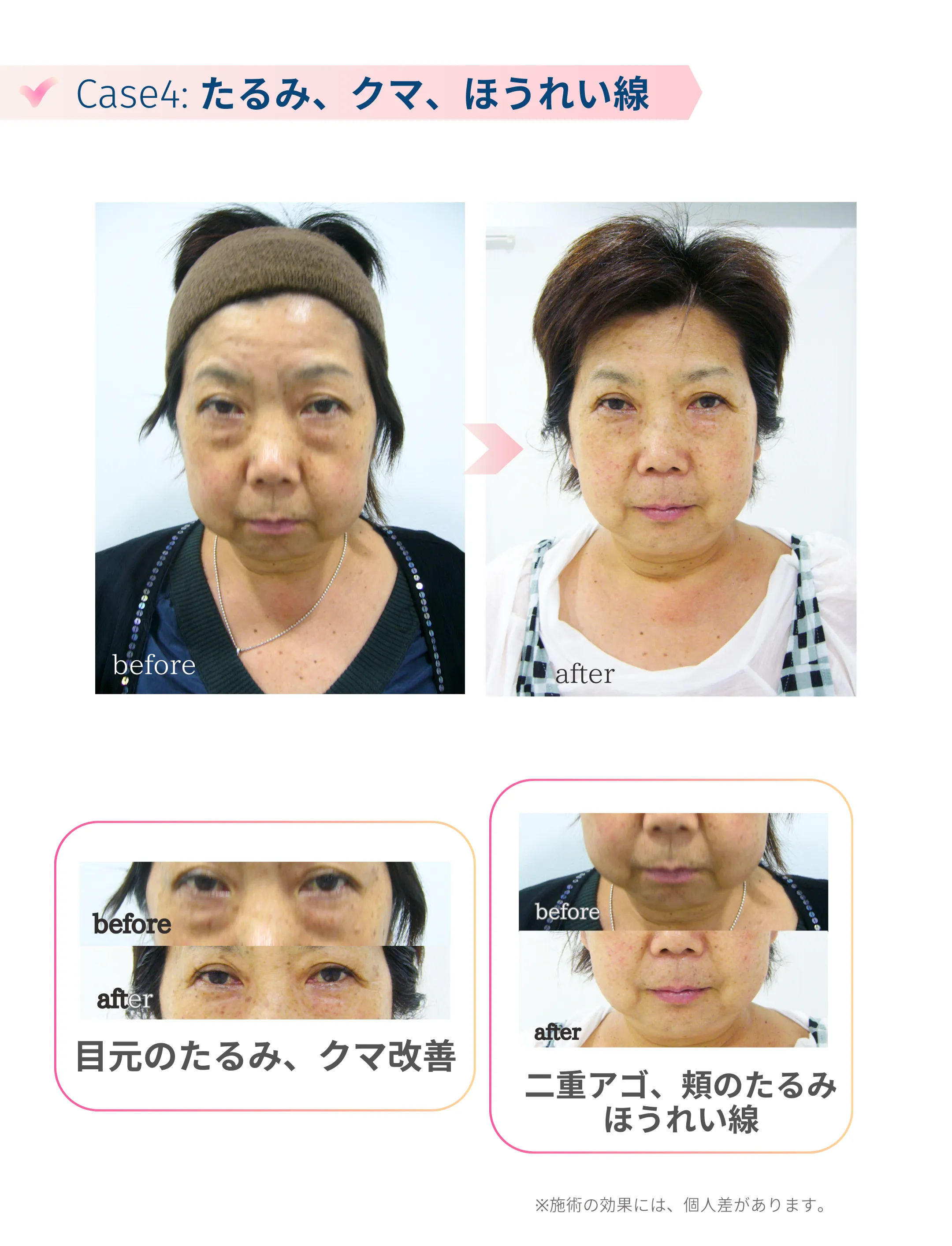 施術例