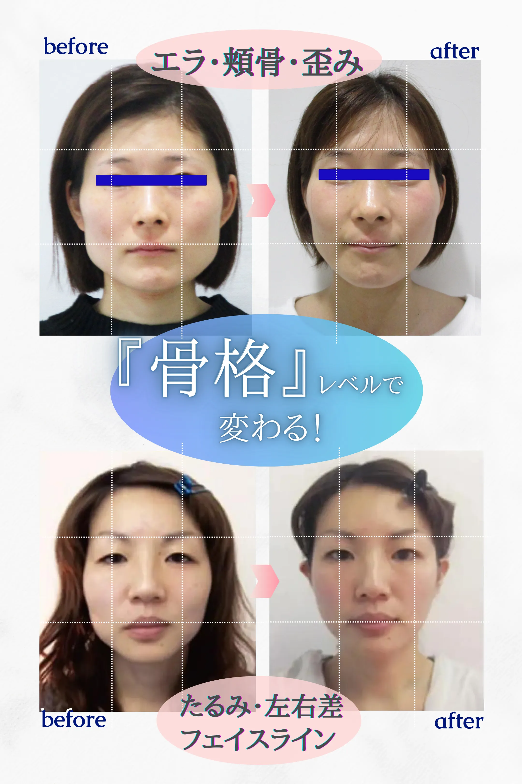 施術例